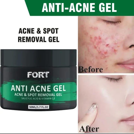 Fort Anti Acne Gel For Acne & Spot Removal